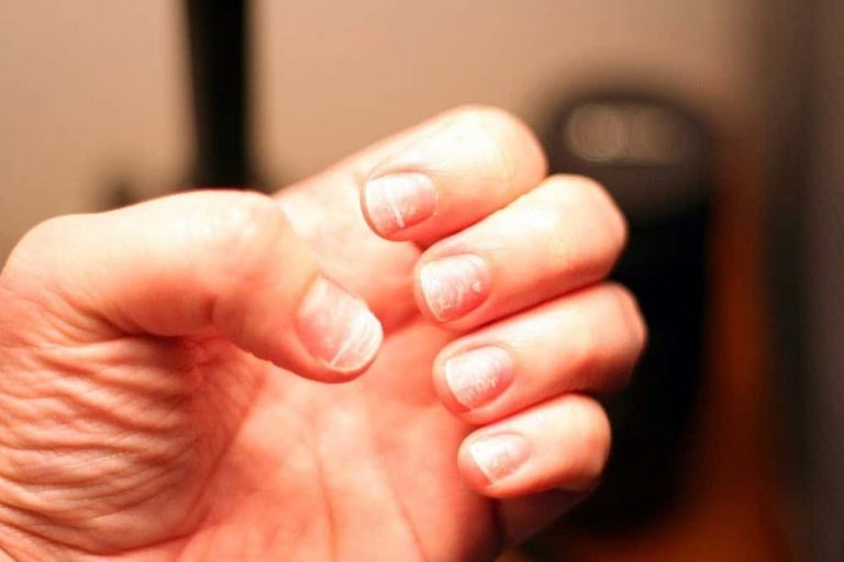 how-to-repair-damaged-nails-after-acrylics